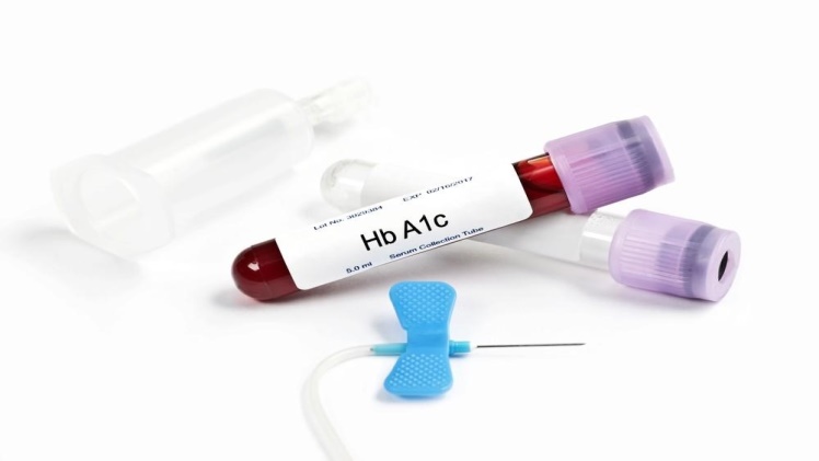 Can you Lower Your A1C Levels? Yes, Here’s How?